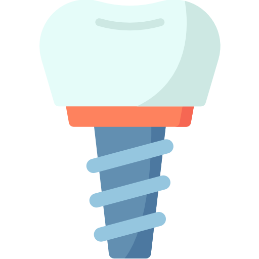 Implantes Dentários